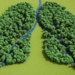 Early Screening and Management Safeguarding Lung Health 