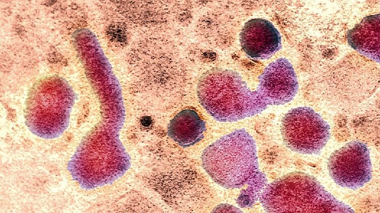 Single H5n1 Mutation Enables Easier Human Infection Study 