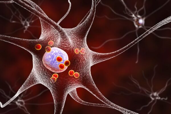 Chinese Researchers Find New Target to Treat Parkinsons Disease 