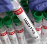 Mpox Outbreaks Continue to Challenge the World Says Who Report 