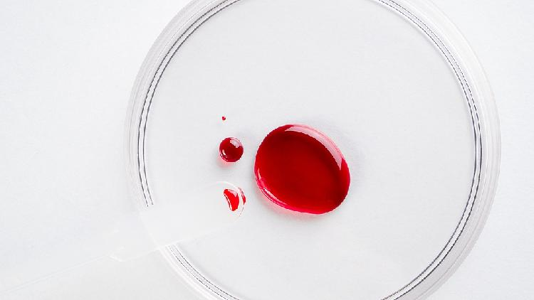 Over 85% of Australians Have ‘Forever Chemicals’ in Their Blood, New Study Reveals 'Forever chemicals' detected in blood of over 85% of Australians