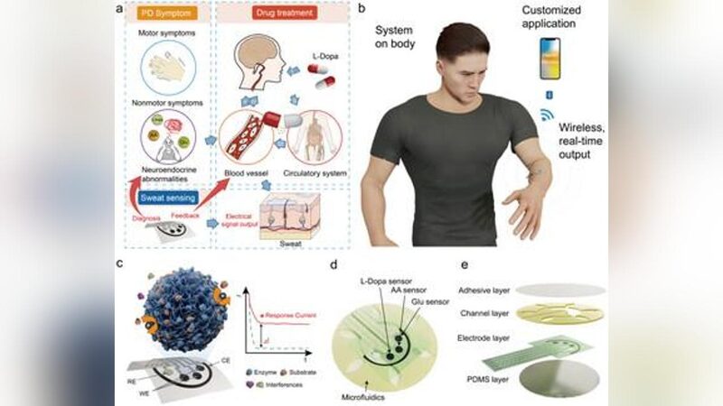 # - My News! Chinese Scientists Make Wearable Pad for Parkinsons Disease Warning