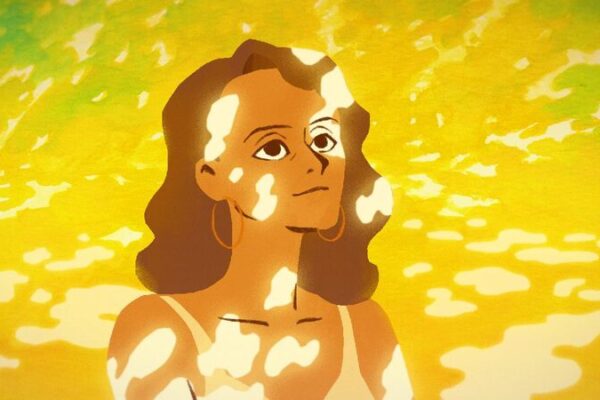 Colourful White: Li Jiahao’s Film Shines Light on Vitiligo Spots and strength: Navigating life with vitiligo