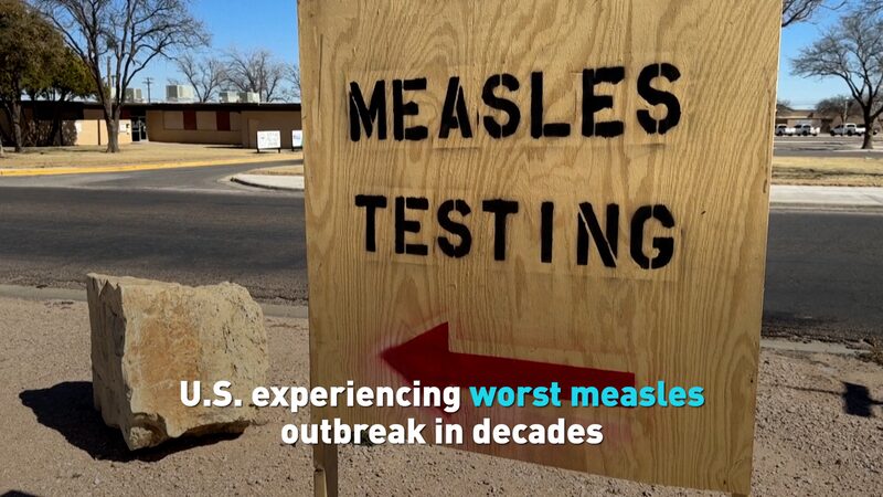 # - My News! Us Experiencing Worst Measles Outbreak in Decades Video Poster